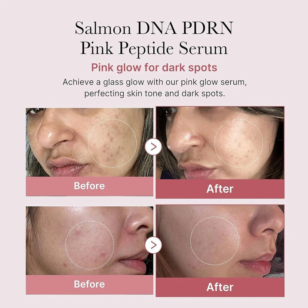 Antes y después reales — manchas oscuras reducidas con PDRN Pink Peptide Serum
