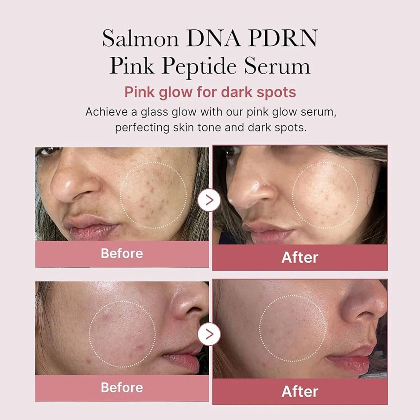 Antes y después reales — manchas oscuras reducidas con PDRN Pink Peptide Serum
